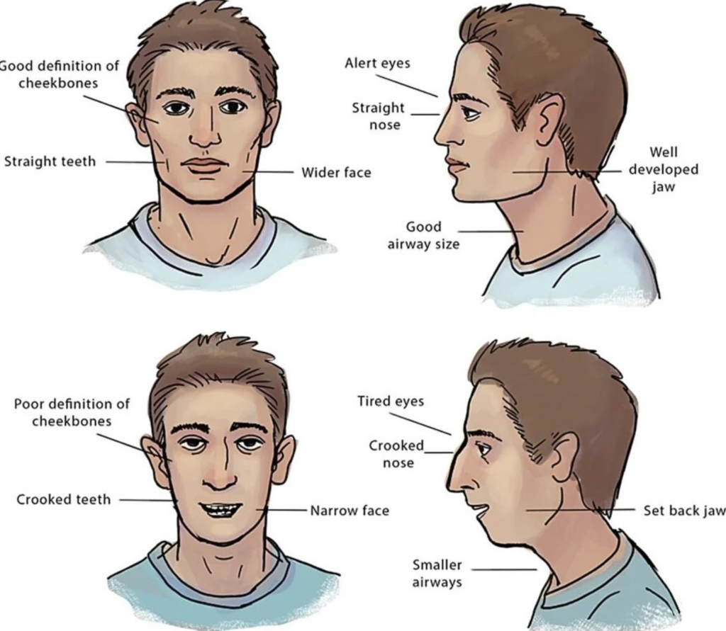 IMAGEN COMPARATIVA ENTRE UNA CARA LARGA Y UNA CARA CORRECTA.